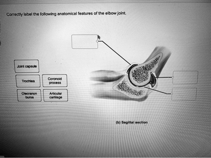 SOLVED Correctly label the following anatomical features of the elbow