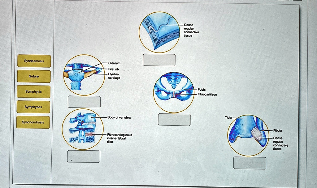 Syndesmosis Suture Sternum -First rib -Hyaline cartilage Symphysis ...