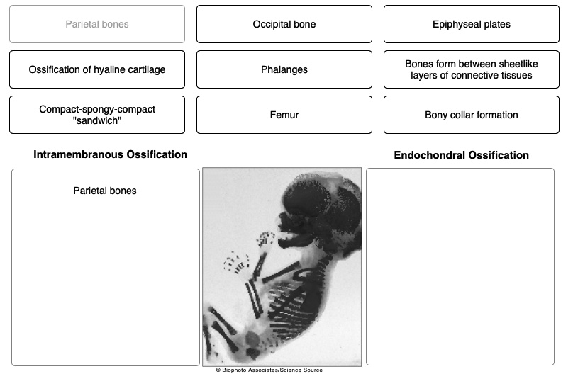 SOLVED Parietal bones Occipital bone Epiphyseal plates Ossification of