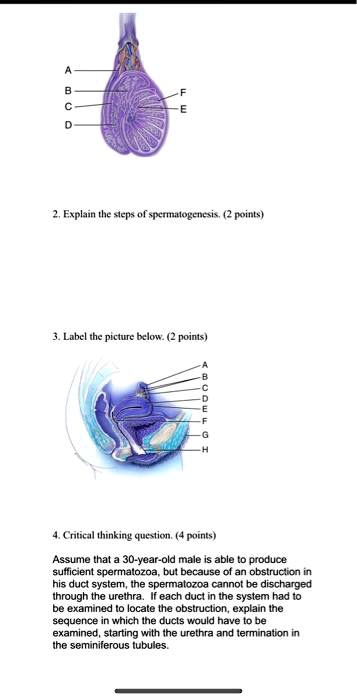 A
B
C
D
E
F
2. Explain the steps of spermatogenesis. (2 points)
3. Label the picture below. (2 points)
A
B
C
D
E
F
G
H
4. Critical thinking question. (4 points)
Assume that a 30-year-old male is able to produce
sufficient spermatozoa, but because of an obstruction in
his duct system, the spermatozoa cannot be discharged
through the urethra. If each duct in the system had to
be examined to locate the obstruction, explain the
sequence in which the ducts would have to be
examined, starting with the urethra and termination in
the seminiferous tubules.
