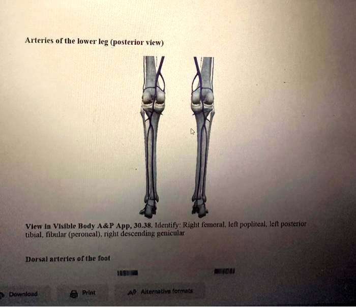 SOLVED: Arteries of the lower leg (posterior view) View in Visible Body ...