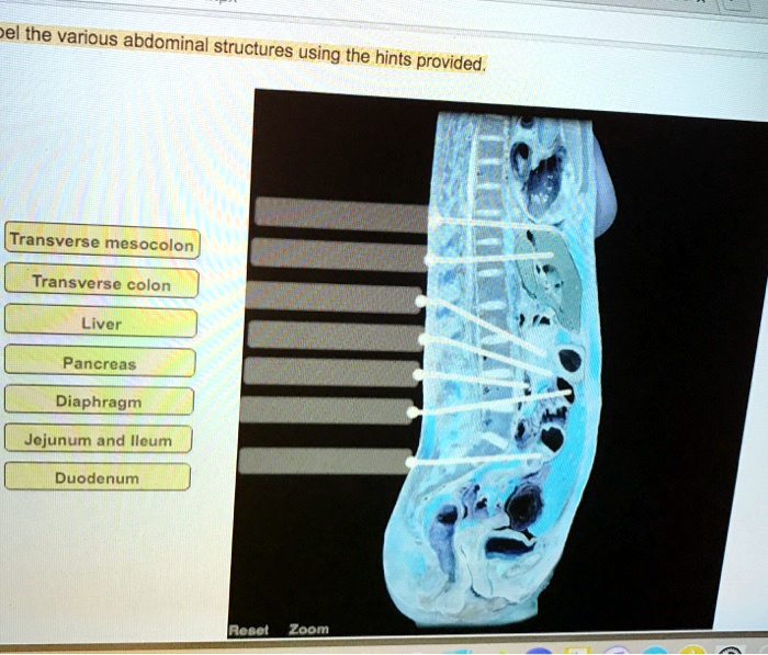 SOLVED el the various abdominal structures using the hints provided