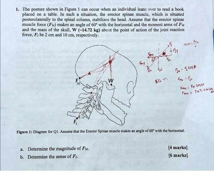 The posture shown in Figure 1 can occur when an individual leans over ...