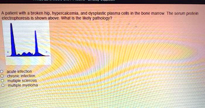 Prolein a palient wilh a broken hip hypercalcemia and dysplastic plasma cells ...