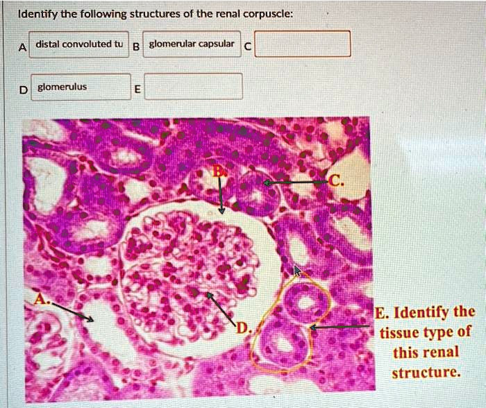 SOLVED: Identify the following structures of the renal corpuscle ...