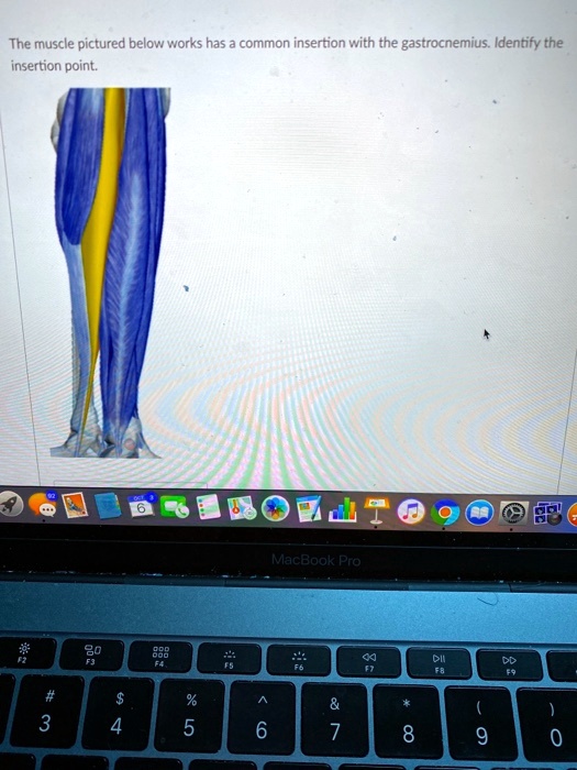 The muscle pictured below works has a common insertion with the gastrocnemius. Identify the insertion point.