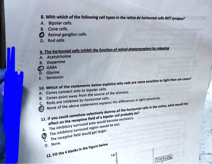 solved-8-with-which-of-the-following-cell-types-in-the-retina-do