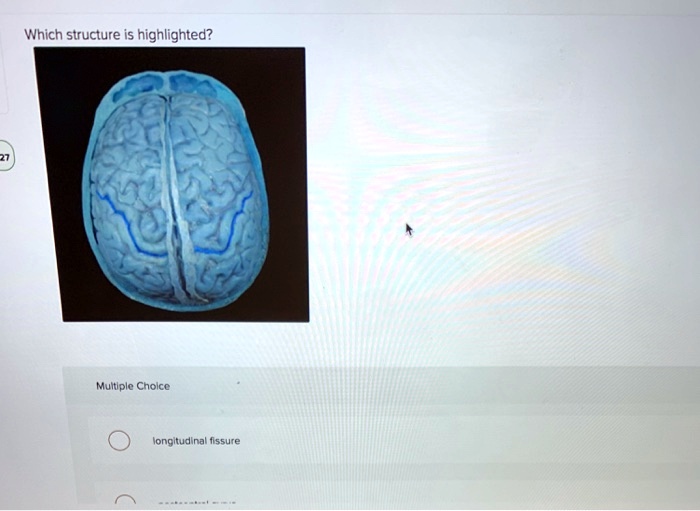 SOLVED: Which structure is highlighted? Multiple Choice longitudinal ...