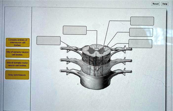 Interneuron Labeled Cell Body