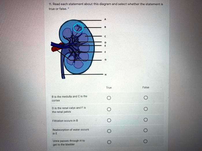 VIDEO solution Read each statement about this diagram and select
