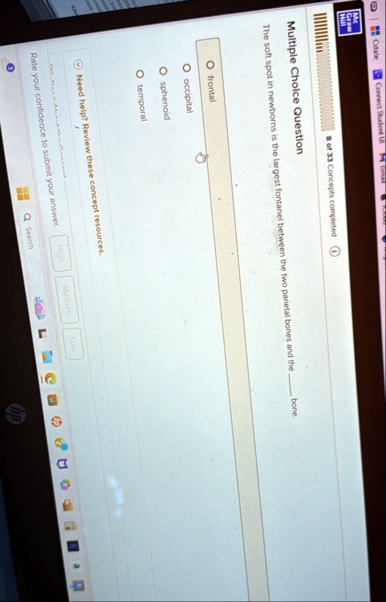mcgraw hill citate connect student ui multiple choice question 8 of 33 concepts completed the soft spot in newborns is the largest fontanel between the two parietal bones and the  bone 05725