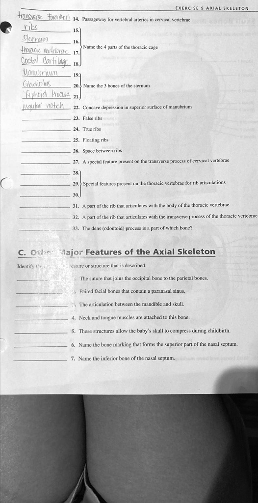 SOLVED: Exercise 9 Axial Skeleton 1. Passageway for vertebral arteries ...