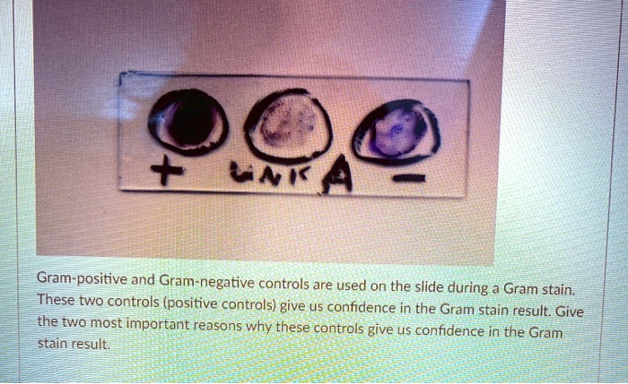 + UNK A -
Gram-positive and Gram-negative controls are used on the slide during a Gram stain. These two controls (positive controls) give us confidence in the Gram stain result. Give the two most important reasons why these controls give us confidence in the Gram stain result.