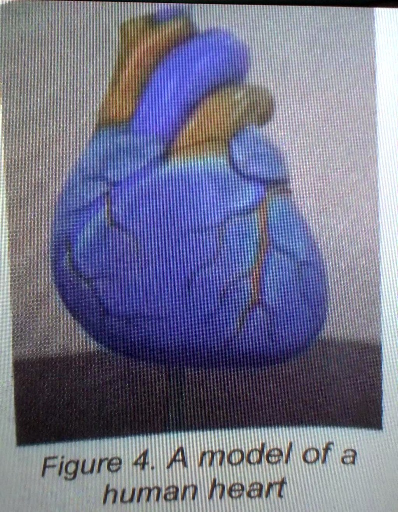 SOLVED 'Q5. Refer to figure 4. What parts of the human heart do you