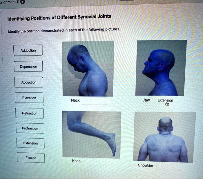 SOLVED: Assignment 8: Identifying Positions of Different Synovial ...