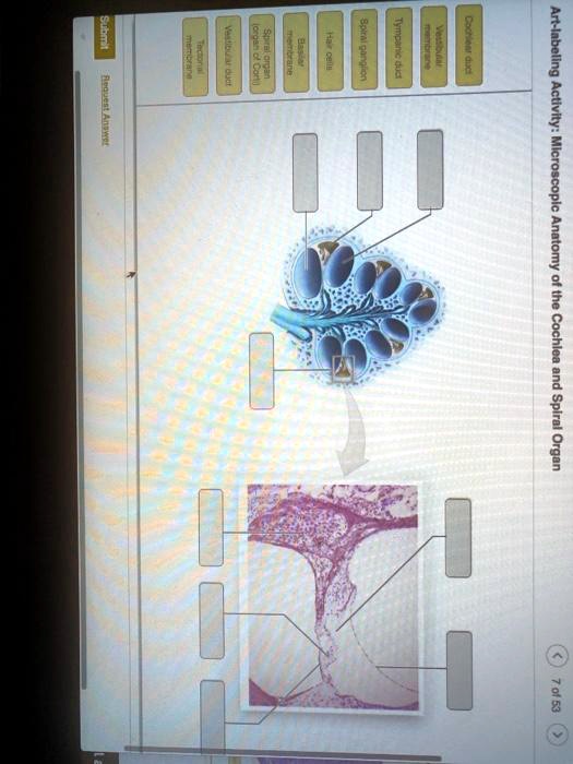 SOLVED An Artlabeling Activity Microscopic Anatomy of the Cochlea