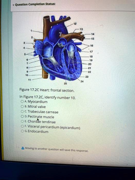 SOLVED Figure 17.2C Heart frontal section. In Figure 17.2C, identify