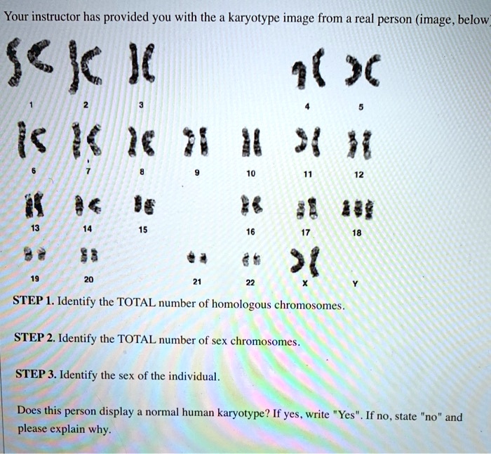 Your Instructor Has Provided You With The A Karyotype Image From Real Person Image Below Sc Jc J 8136