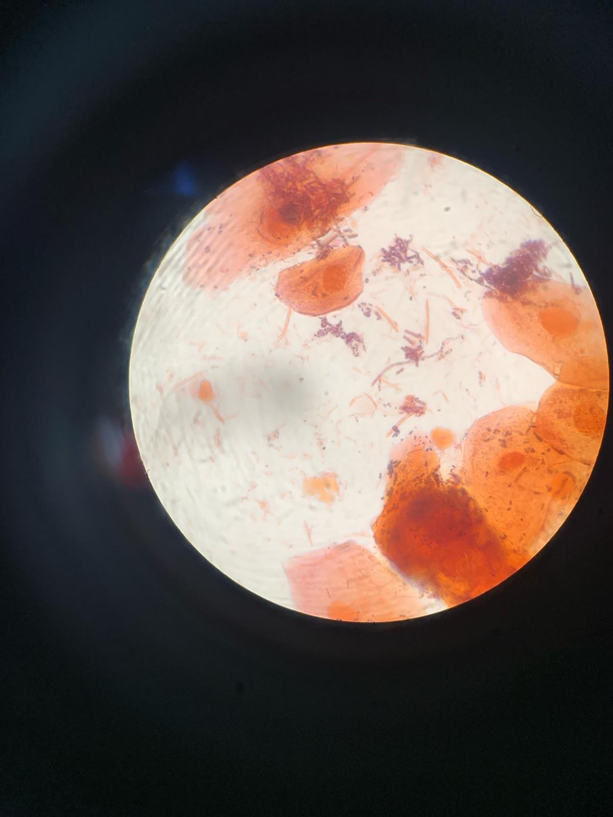 SOLVED: Gram stain lab find and label the different cells