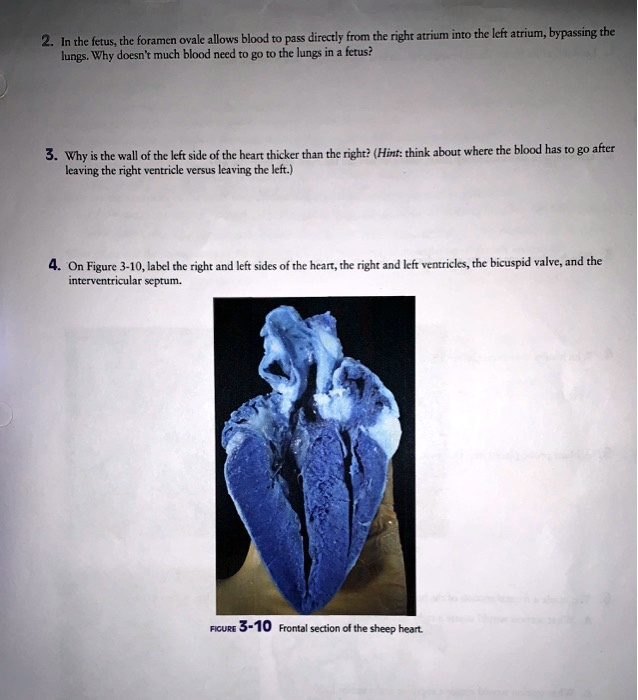 2. In the fetus, the foramen ovale allows blood to pass directly from the right atrium into the left atrium, bypassing the
lungs. Why doesn't much blood need to go to the lungs in a fetus?
3. Why is the wall of the left side of the heart thicker than the right? (Hint: think about where the blood has to go after
leaving the right ventricle versus leaving the left.)
4. On Figure 3-10, label the right and left sides of the heart, the right and left ventricles, the bicuspid valve, and the
interventricular septum.
FIGURE 3-10 Frontal section of the sheep heart.
