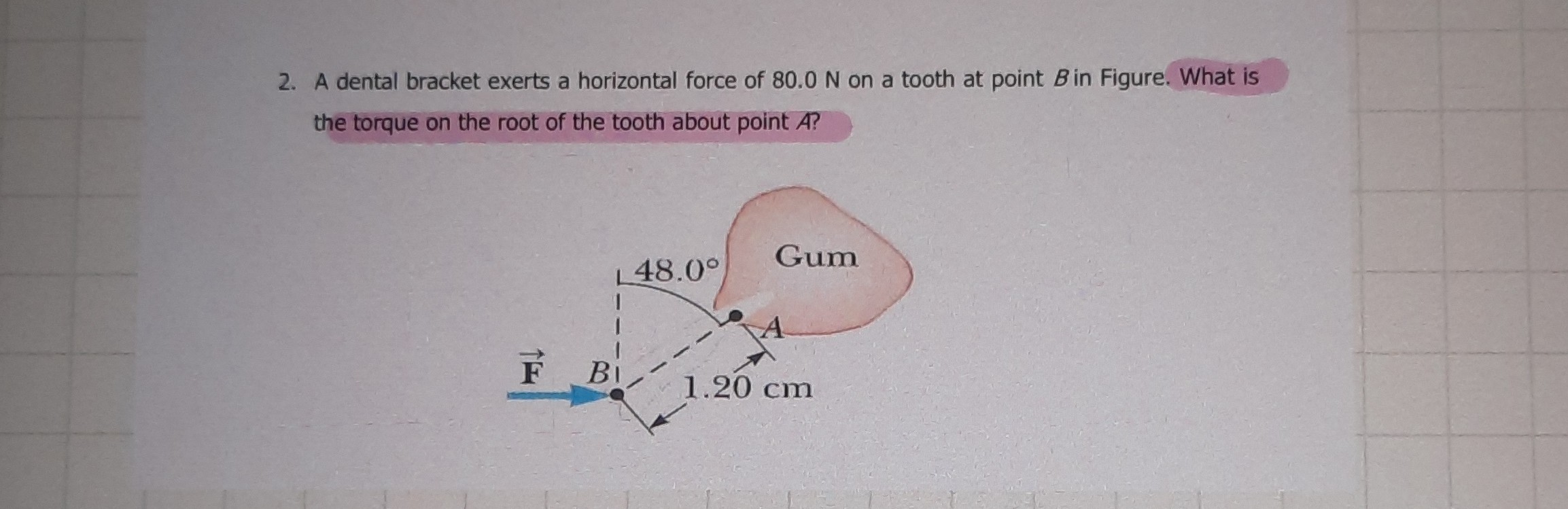2. A dental bracket exerts a horizontal force of 80.0 N on a tooth at