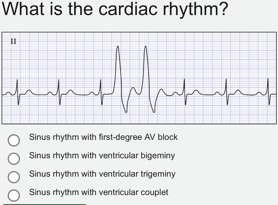 What is the Cardiac Rhythm shown in the EKG strip? Choose from the ...