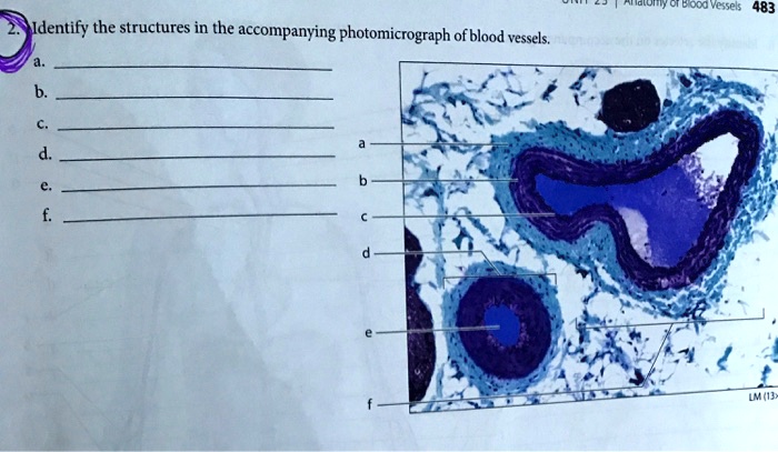 SOLVED: Identify the structures in the accompanying photomicrograph of ...