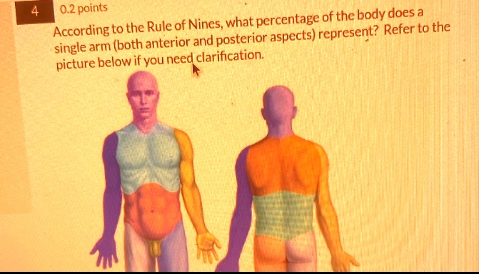 Point Rule 4 0.2 points According to the Rule of Nines, what percentage of the ...
