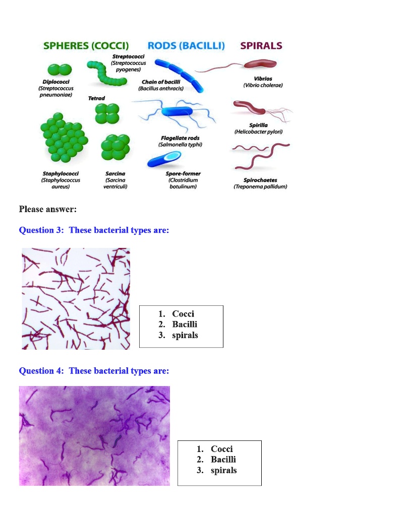 SOLVED SPHERES (COCCI) RODS (BACILLI) Streptococcl (Streptococcus