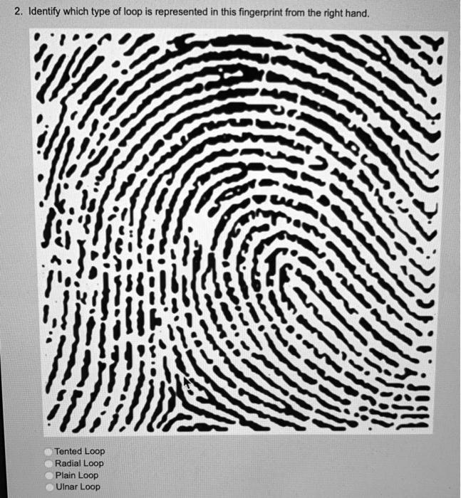 SOLVED: Identify which type of loop is represented in this fingerprint ...