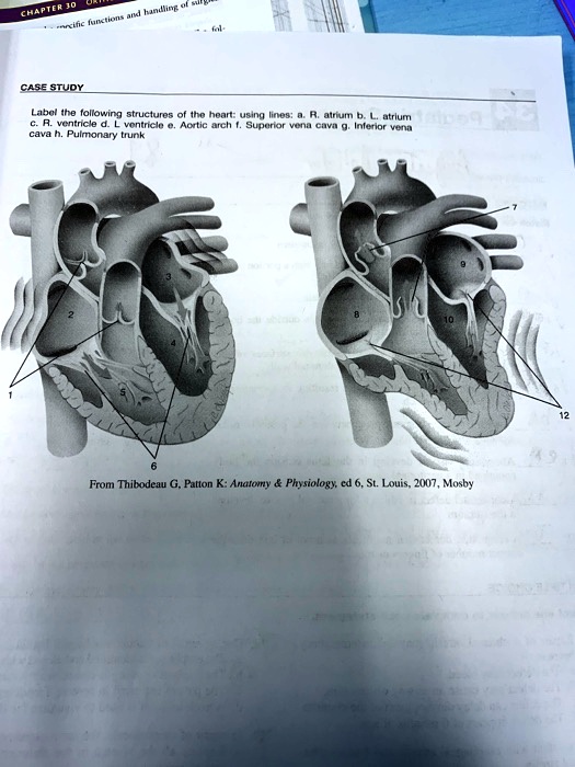 SOLVED: CASE STUDY Label the following structures of the heart using ...