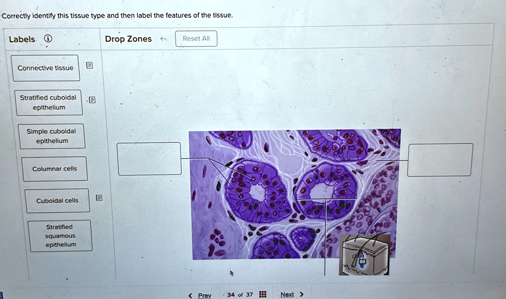 [GET ANSWER] Correctly identify this tissue type and then label the ...