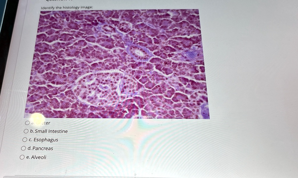 Identify the histology image:
a. ureter
b. Small Intestine
c. Esophagus
d. Pancreas
e. Alveoli