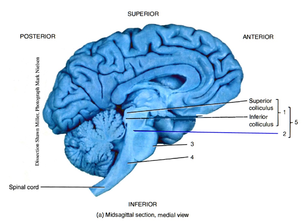 solved-label-the-brain-stem-structures-in-the-figure-below-word-bank