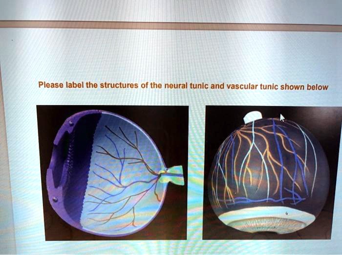 SOLVED Please label the structures of the neural tunic and vascular