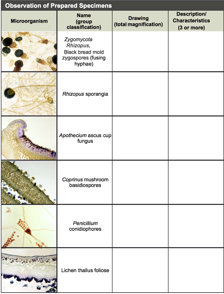 solved-observation-of-prepared-specimens-name-drawing-microorganism