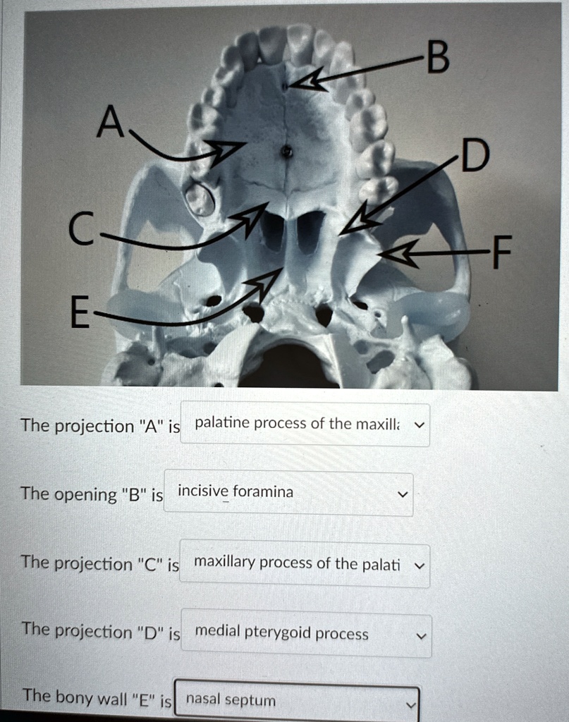 Bonye Process B A C E The projection