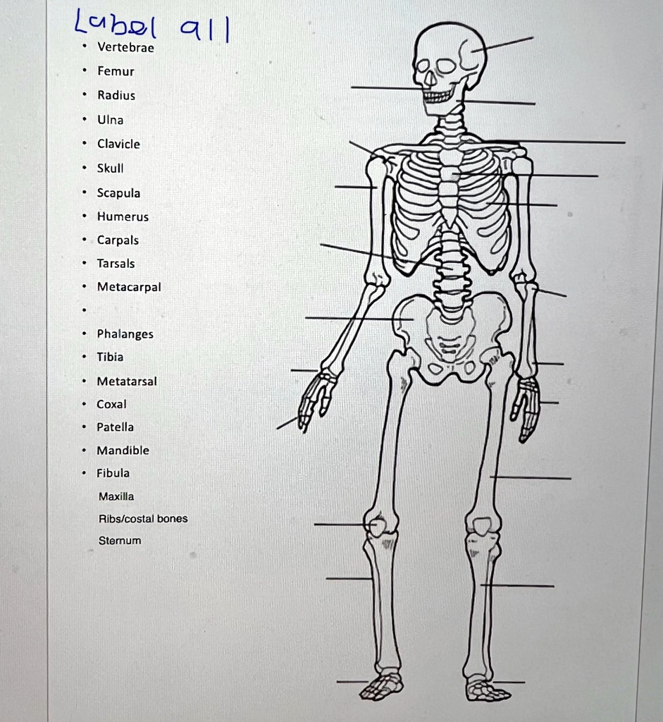 Label all Vertebrae Femur Radius Ulna Clavicle Skull Scapula Humerus ...