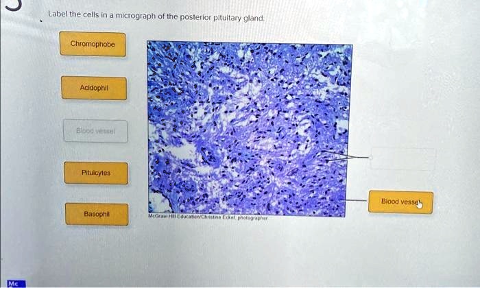 Solved: Texts: Label The Cells In A Micrograph Of The Posterior 