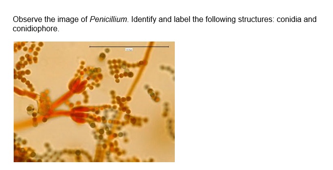 SOLVED: Observe the image of Penicillium. Identify and label the ...