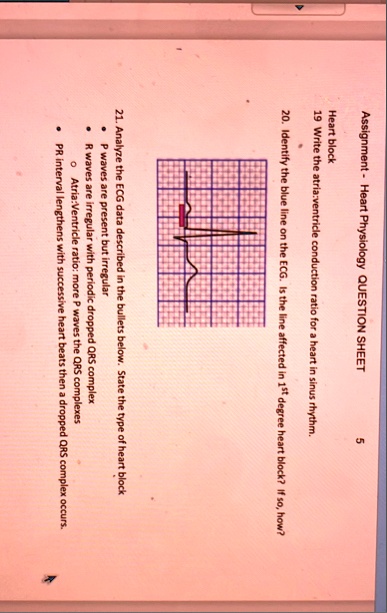 assignment heart physiology question sheet 5 heart block 19 write the ...