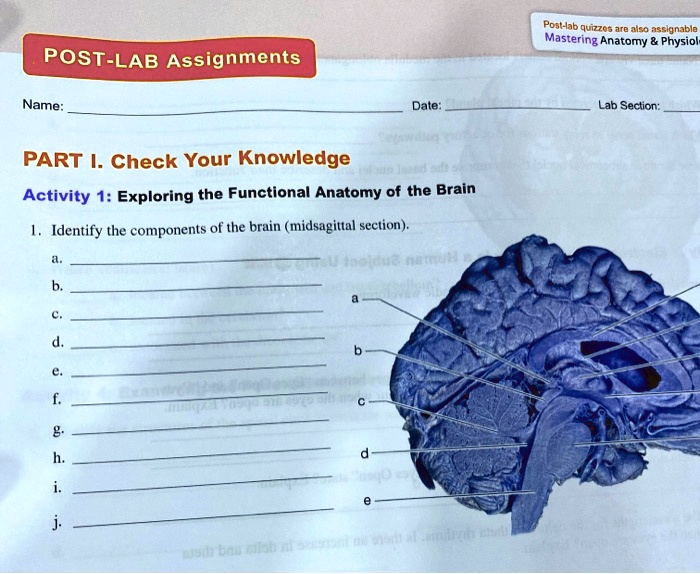 SOLVED Postlab quizzes are also assignable in Mastering Anatomy