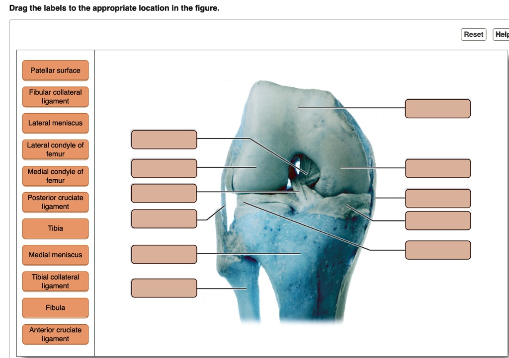 SOLVED: Drag the labels to the appropriate location in the figure. Drag ...