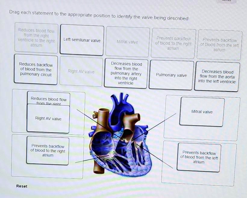 Drag each statement to the appropriate position to identify the valve