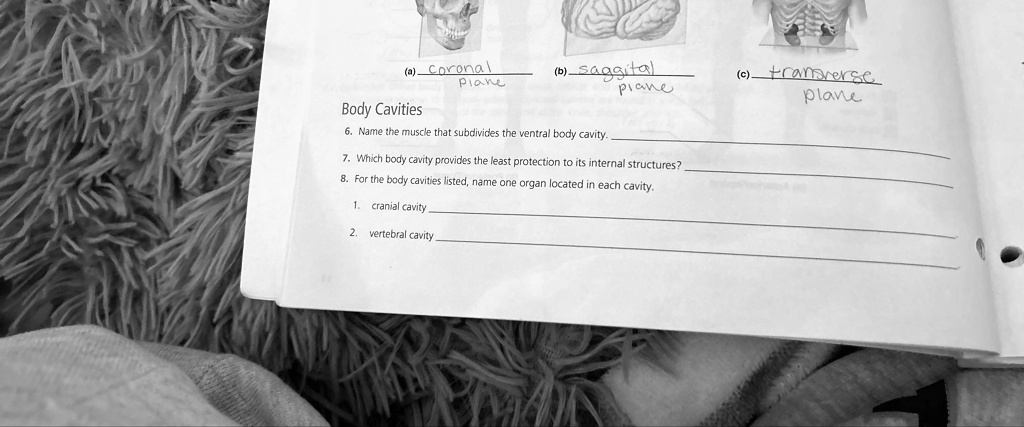 Which Body Cavity Provides The Least Protection (a) (coronal)/(plane) (b) sagittal (c) transverse plane Body Cavities 6