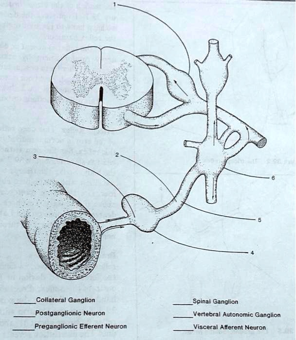 SOLVED: Collateral Ganglion Spinai Ganglion Vertebral Autonomic ...