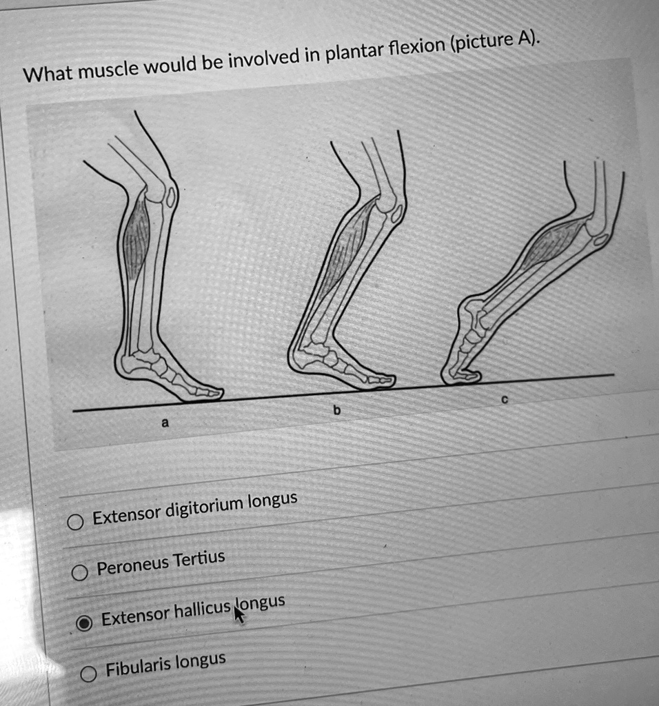 What muscle would be involved in plantar flexion (picture A)? a b c ...