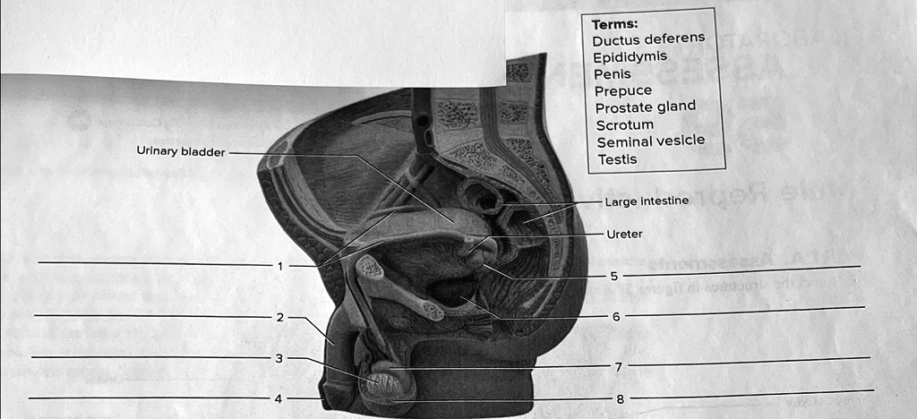 SOLVED: Label the diagram of the sagittal section of a testis. Terms ...