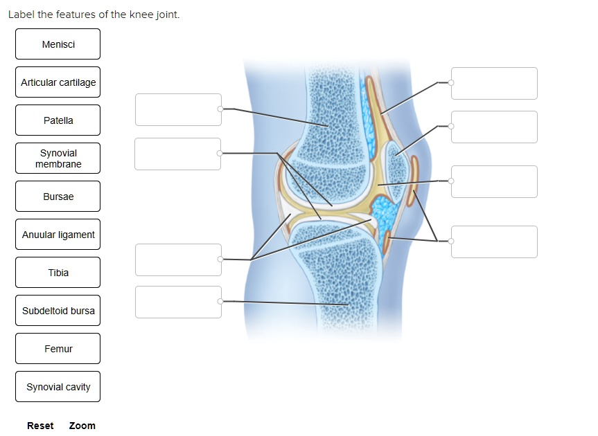 SOLVED: Label the features of the knee joint: - Menisci - Articular ...