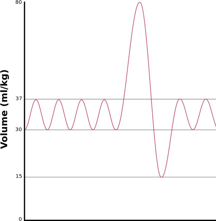 SOLVED a. Based on the diagram, identify which lung volumes and